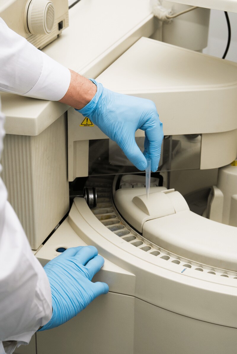 Lab automation